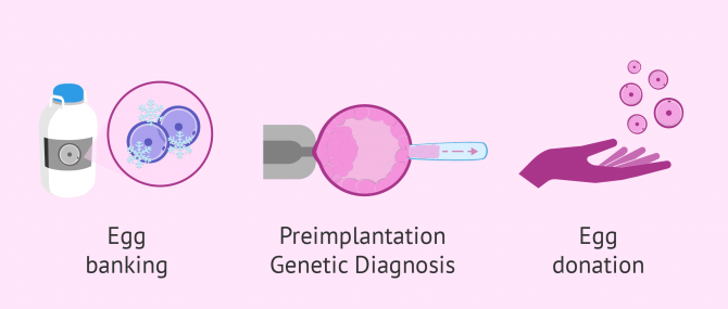 Imagen: Fertility options for women over 40