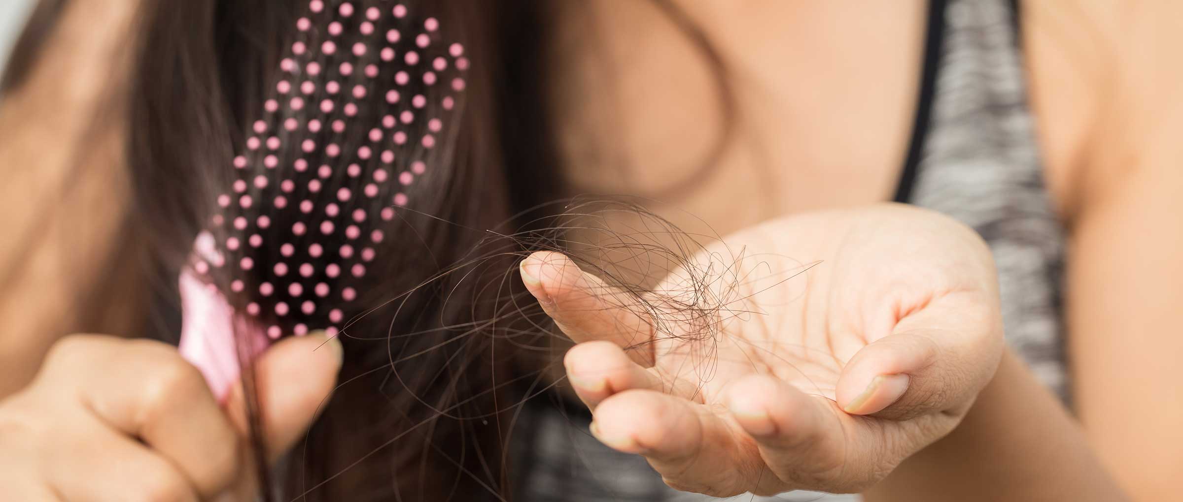 Hair loss after labour