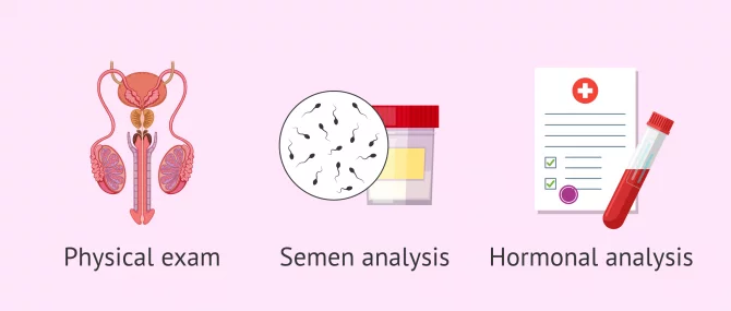 Imagen: Basic male fertility tests