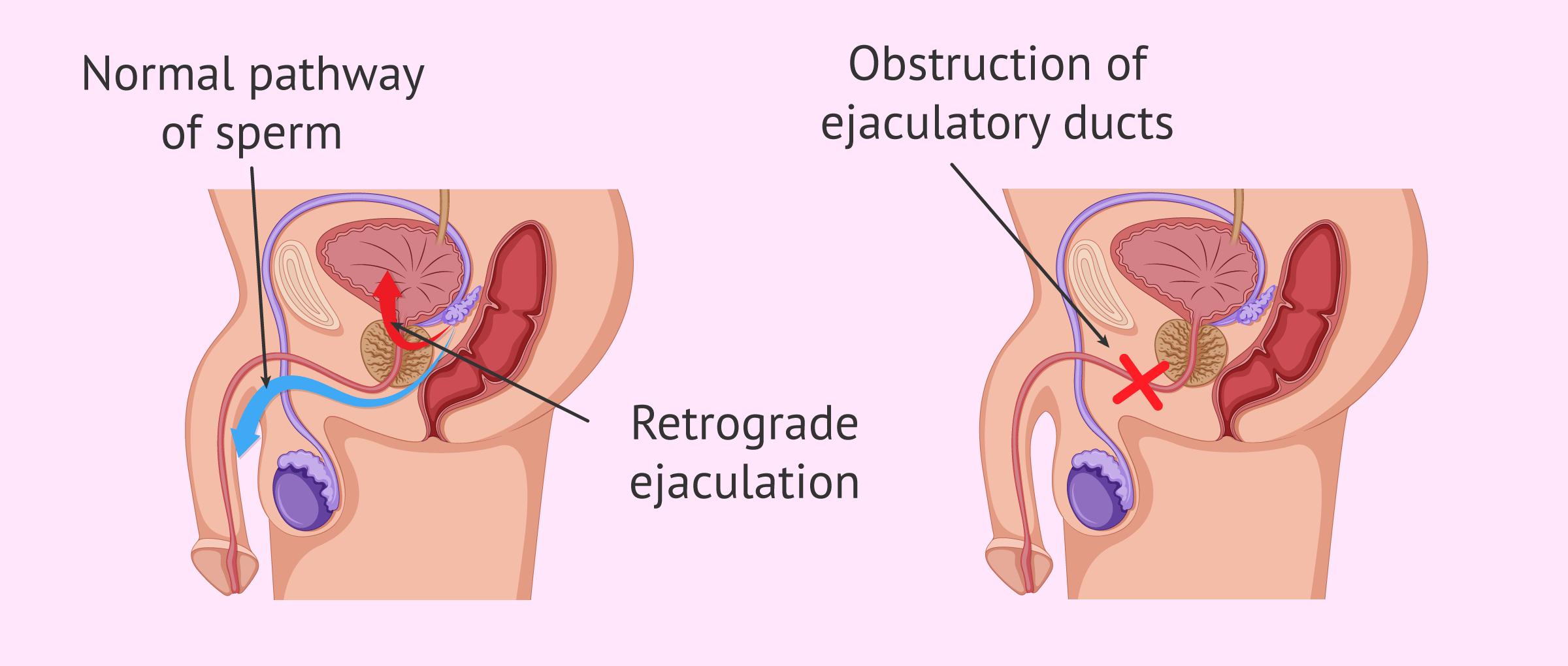 Masturbation Without Ejaculation