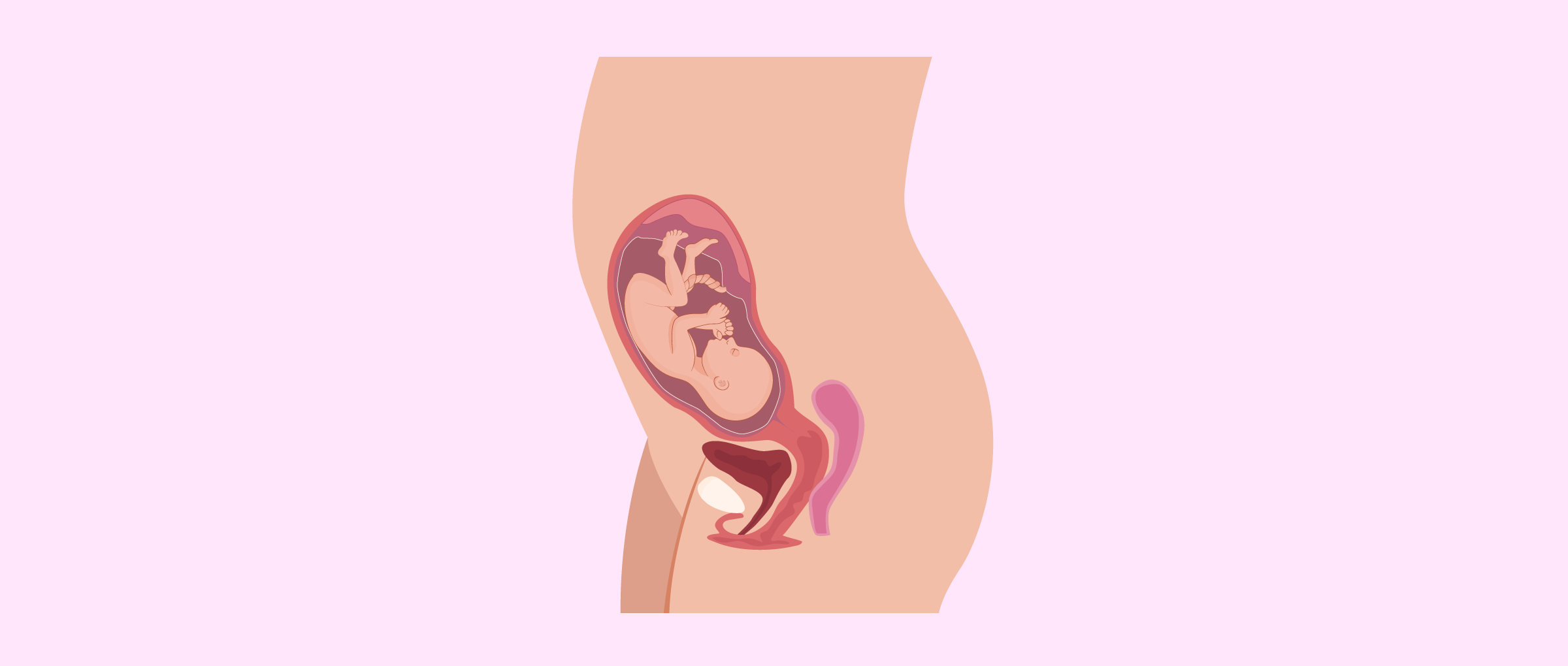 Completely developed fetus at month 7
