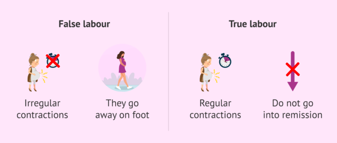 Imagen: Differences between false labour and true labour