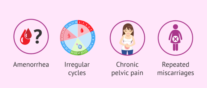 Imagen: Fertility disorders in women with celiac disease