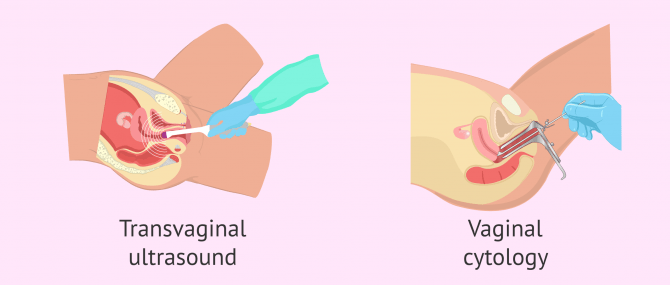Imagen: Gynecological tests to check if a woman is fertile