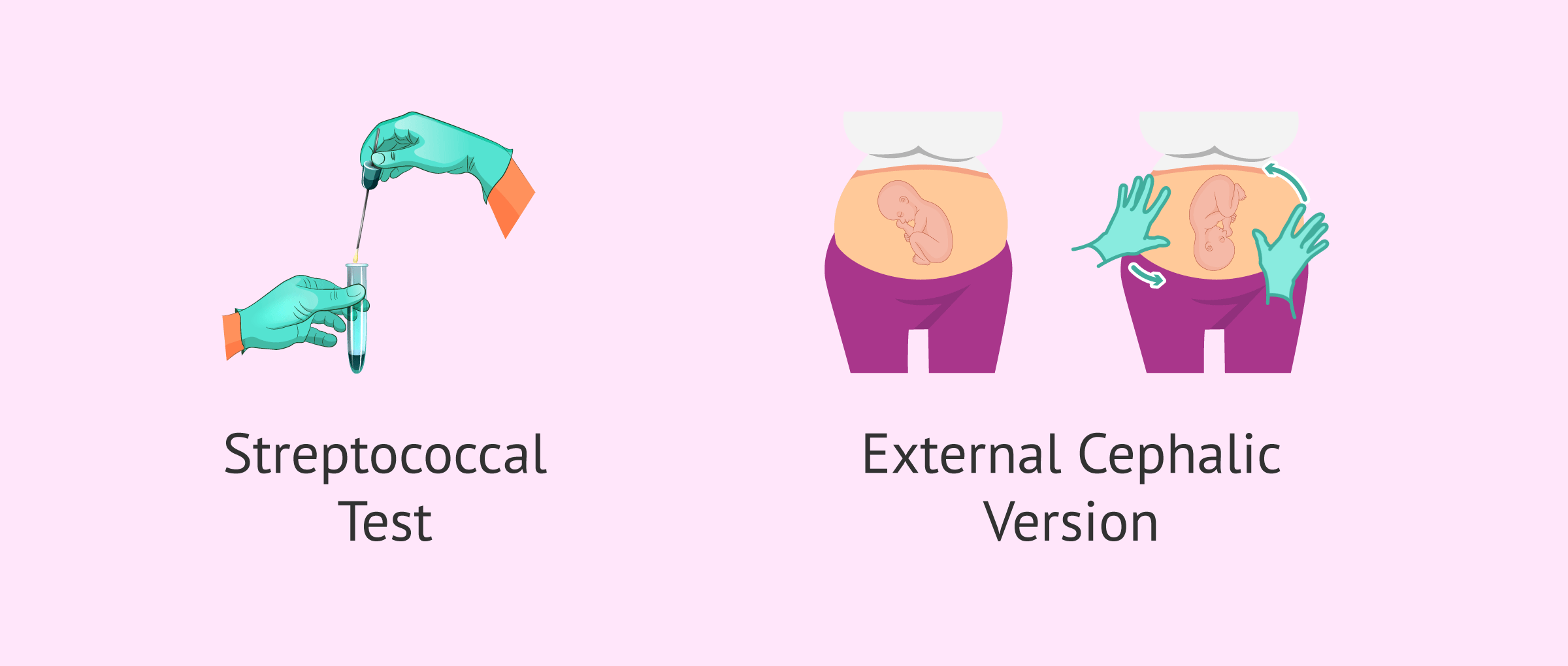 Imagen: Tests in week 37 of pregnancy