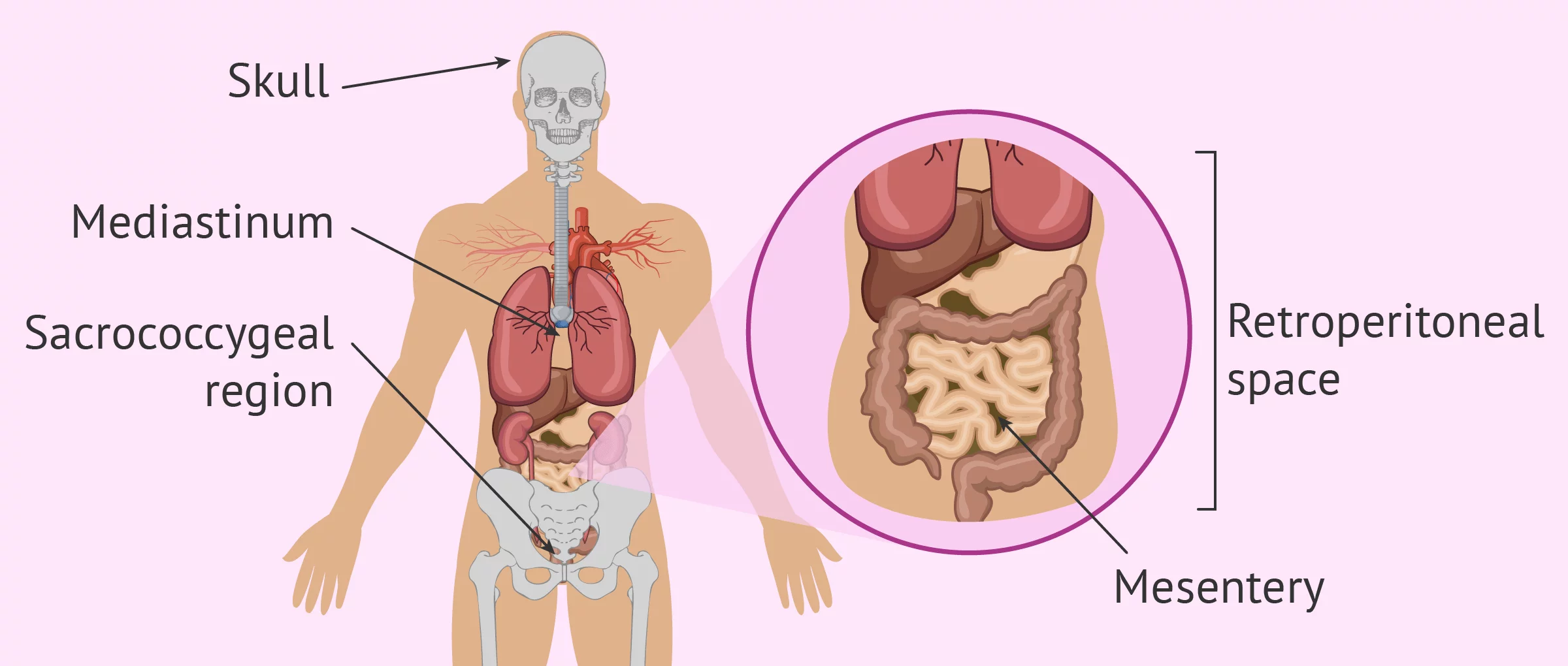 Where do teratomas grow most commonly?