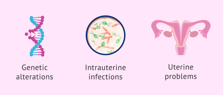 Causes of missed abortion