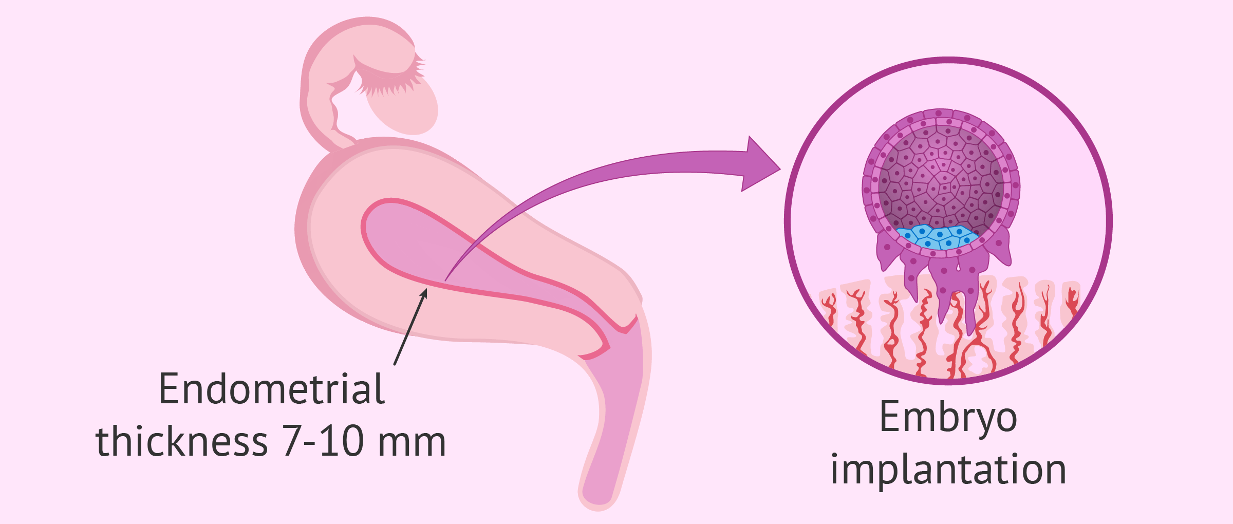 Endometrio embarazo