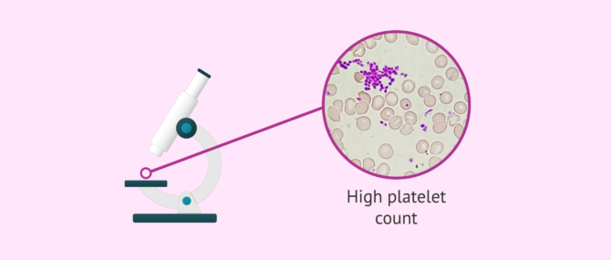 Imagen: Visualization of platelets under the microscope