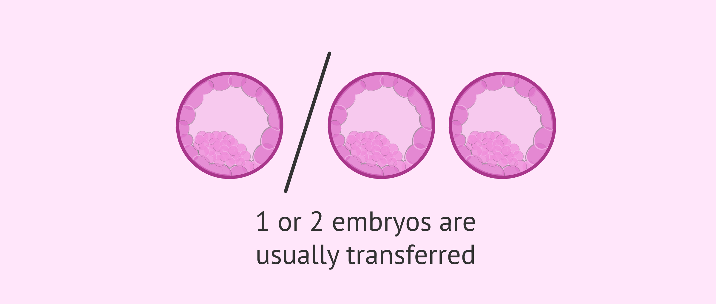 Transfer of 1 or 2 embryos