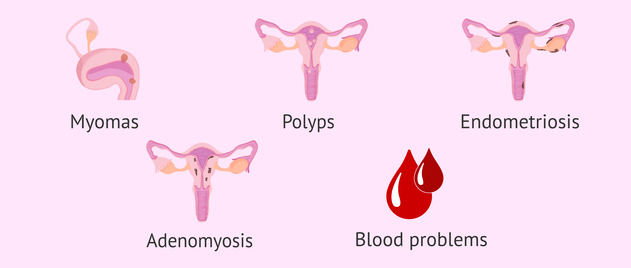 Possible pathologies after menstrual clots