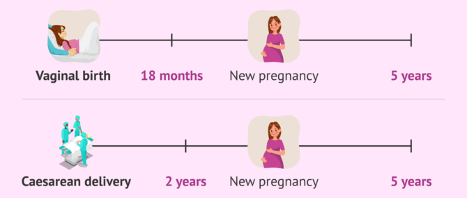 Imagen: How long to wait after a birth to look for a new child?