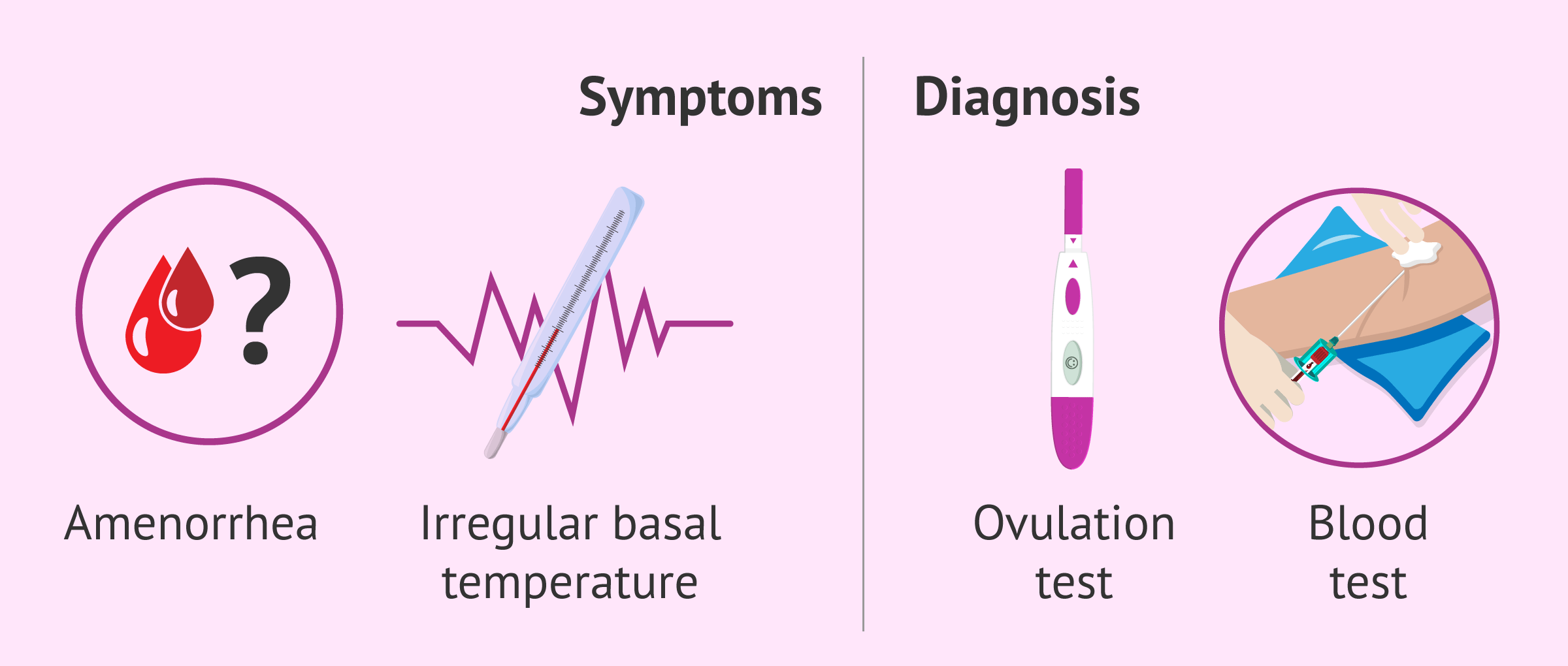 Symptoms and diagnosis of anovulation