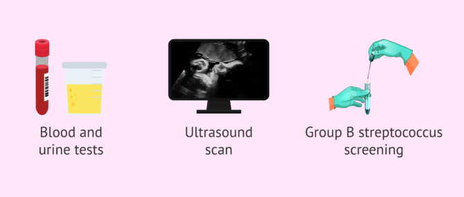 Imagen: Check-ups and tests in the 36th week of pregnancy