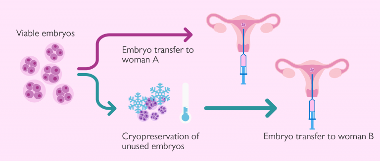 Donating Surplus IVF Embryos To Other Couples