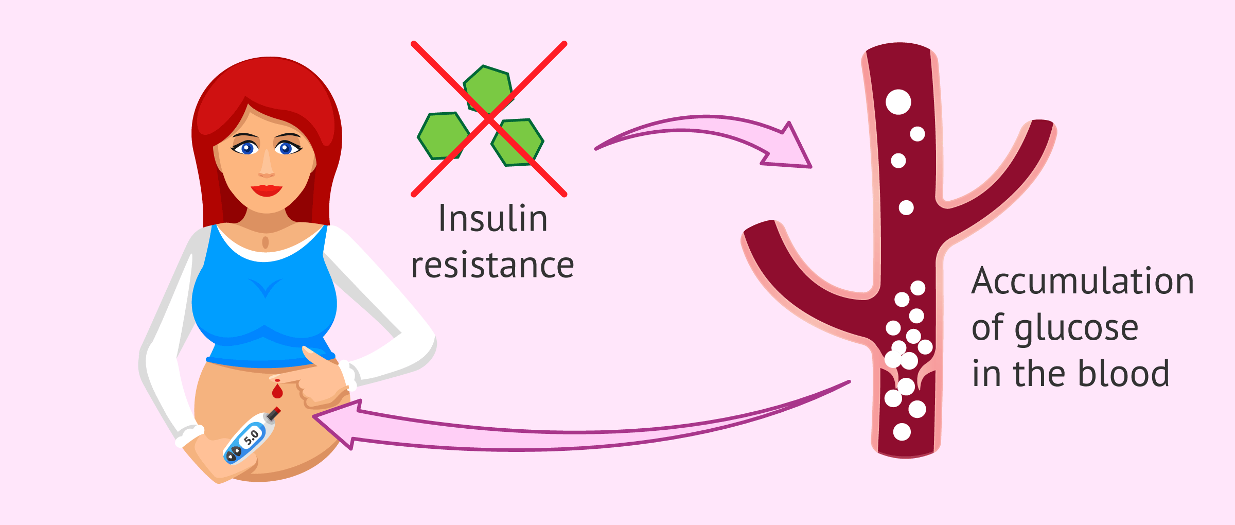 Resistencia insulina adelgazar