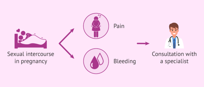 Imagen: Sexual intercourse in pregnancy