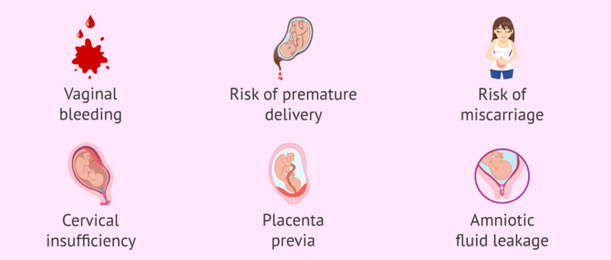 Imagen: Contraindications to sexual intercourse in pregnancy