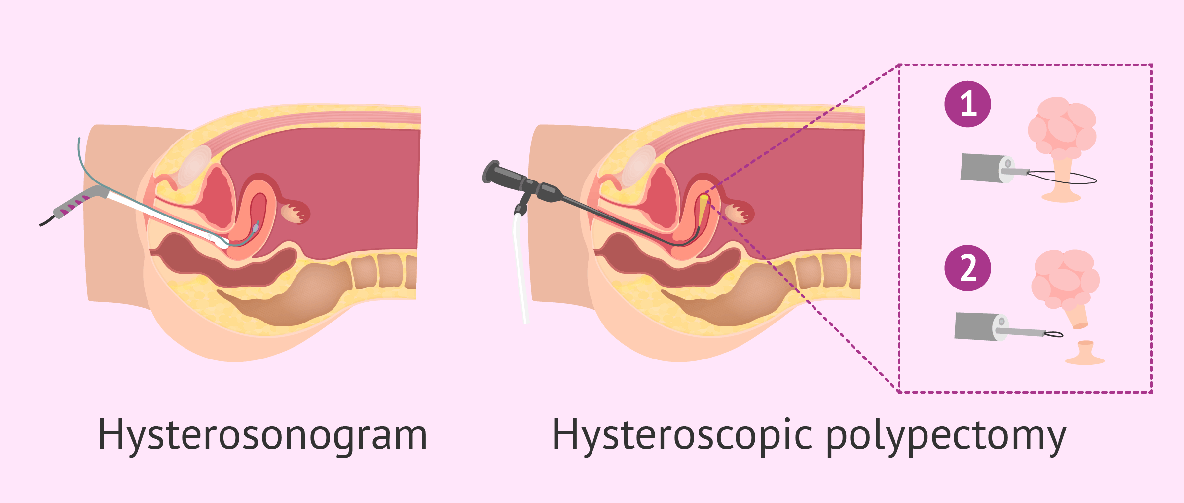 Fertility investigations