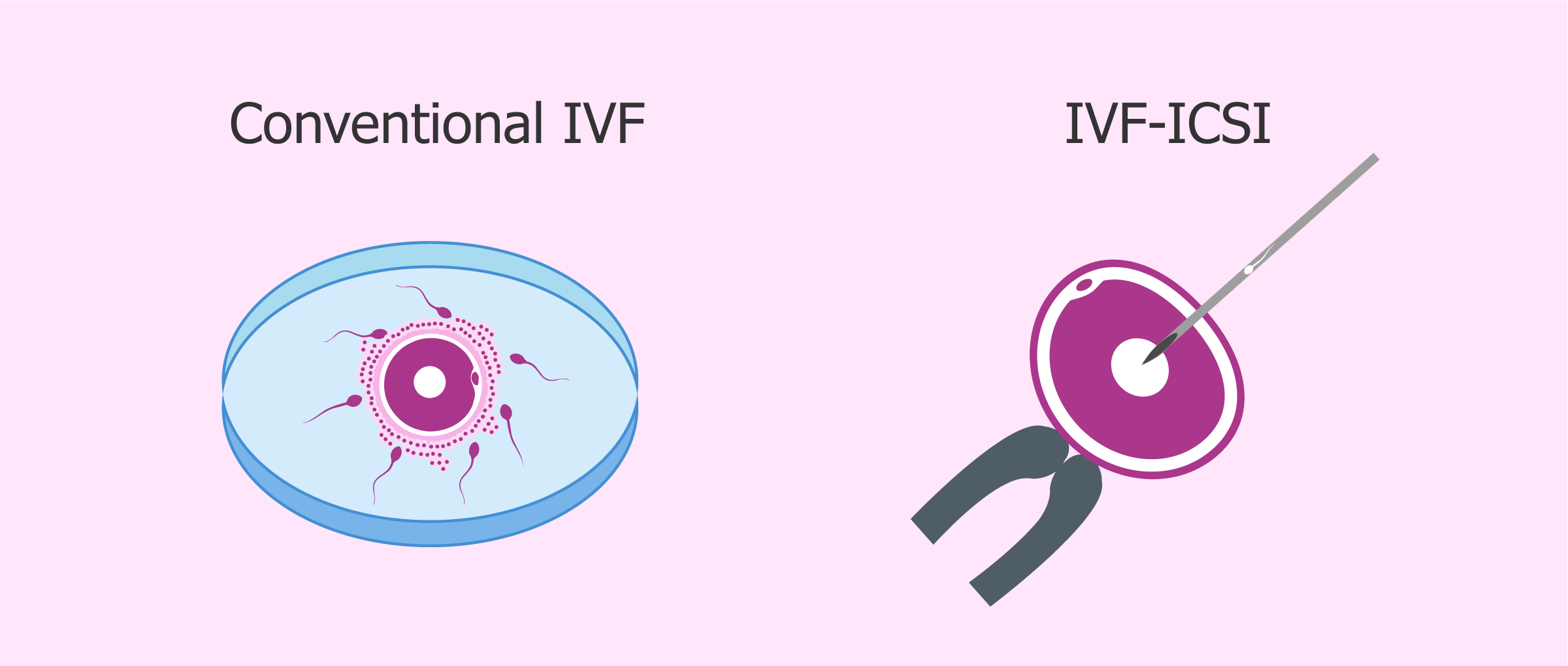 Difference between ICSI and IVF