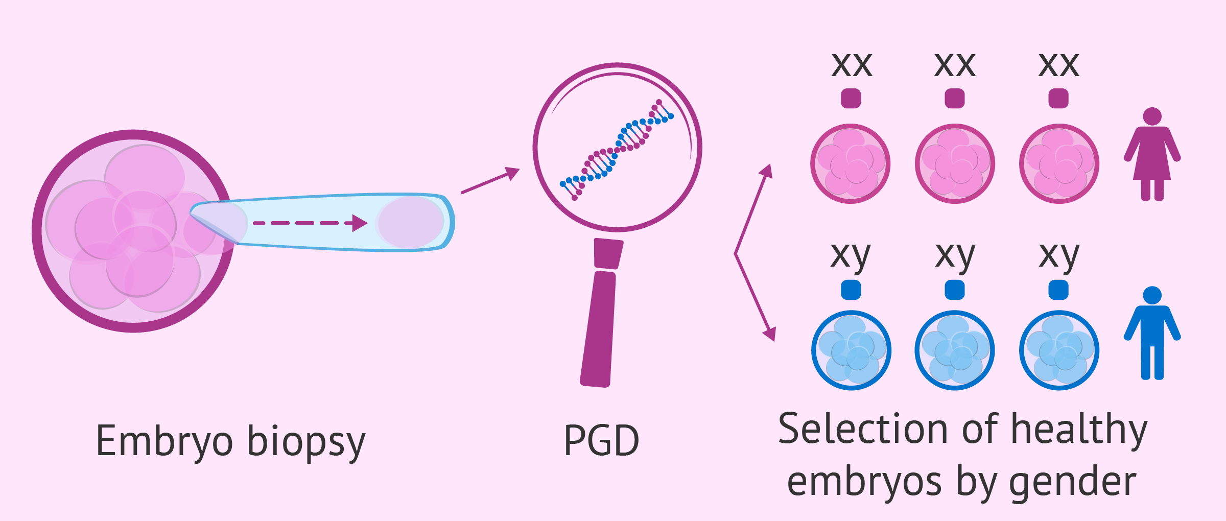 Process of PGD for gender selection