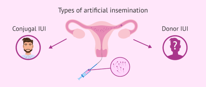 What Is Artificial Insemination (AI)? – Process, Cost & Types