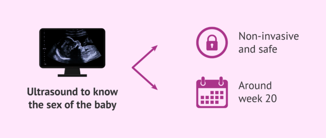 Imagen: Ultrasound as a common method to know the sex of the baby