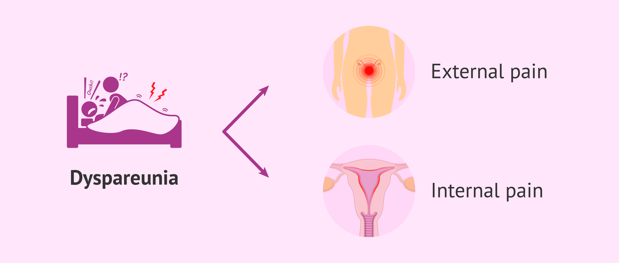 Why does pain during sexual intercourse, or dyspareunia, occur?