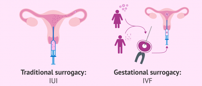 Difference between traditional surrogacy and gestational surrogacy