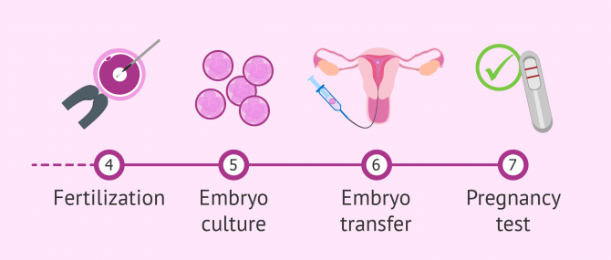 IVF process from fertilization to transfer