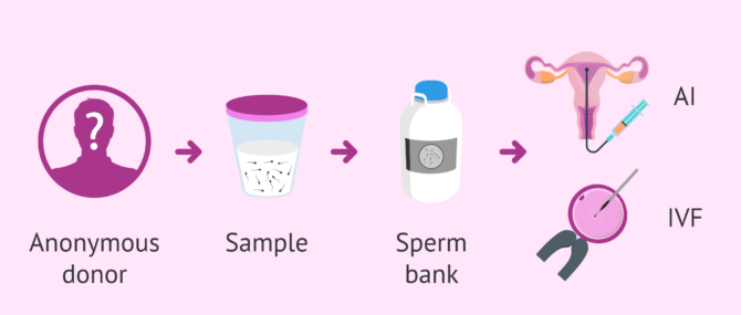 Using donated sperm: donor requirements, prices and treatments