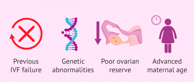 Imagen: When to use donor eggs in IVF