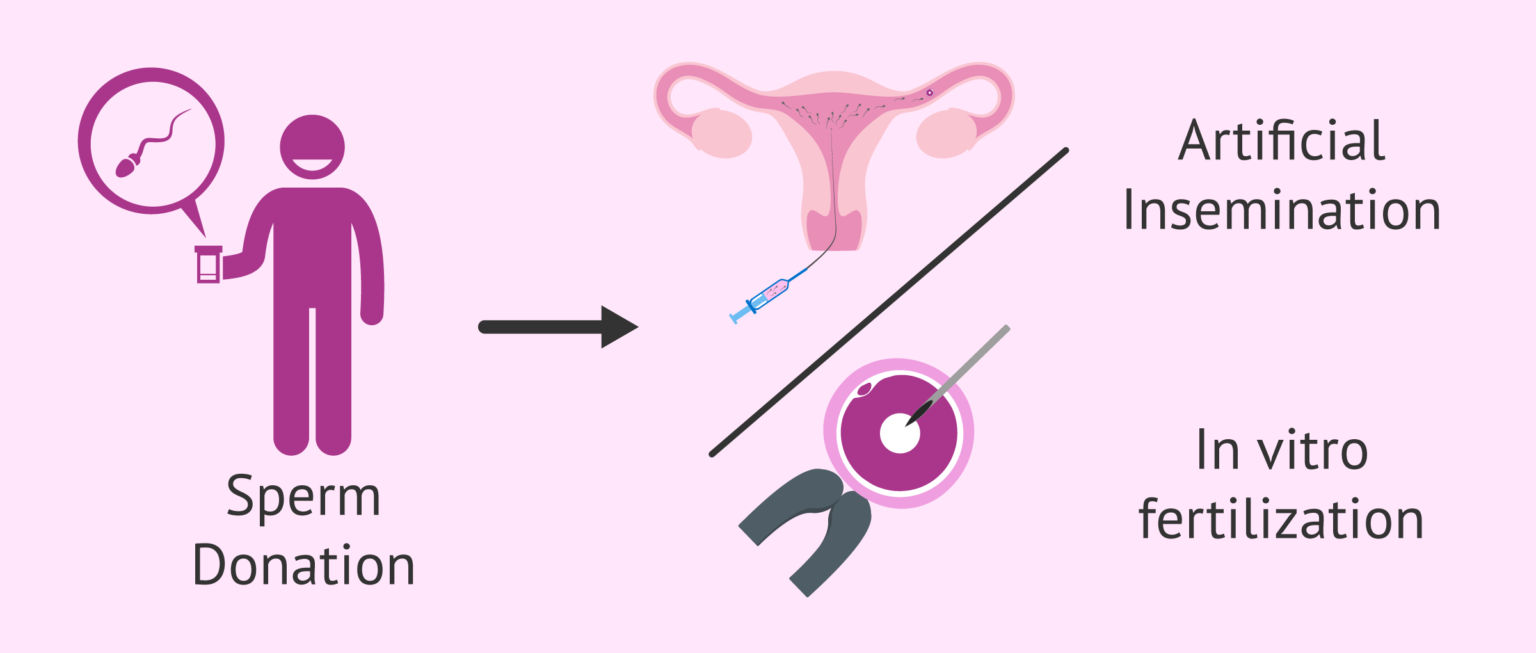 Sperm donation for artificial insemination or for IVF