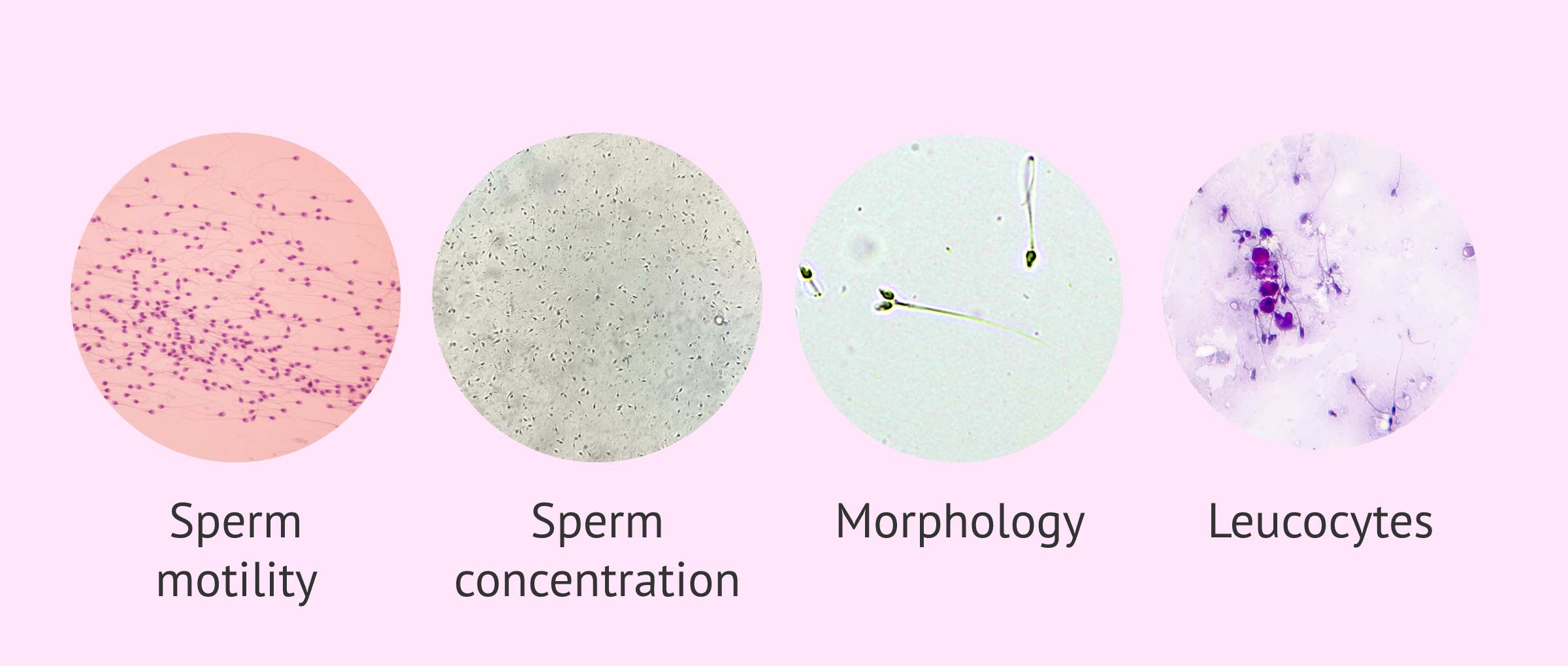 semen under microscope