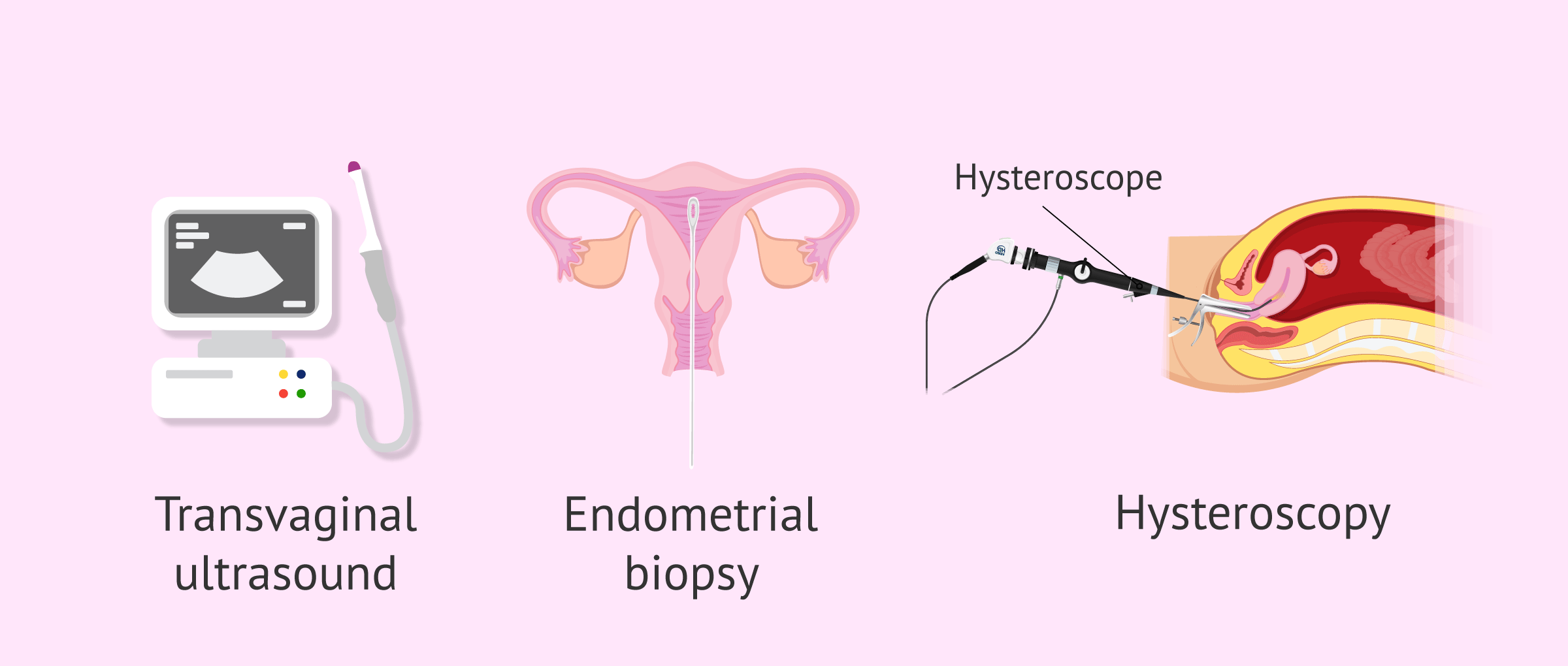 Diagnostic tests for endometrial hyperplasia