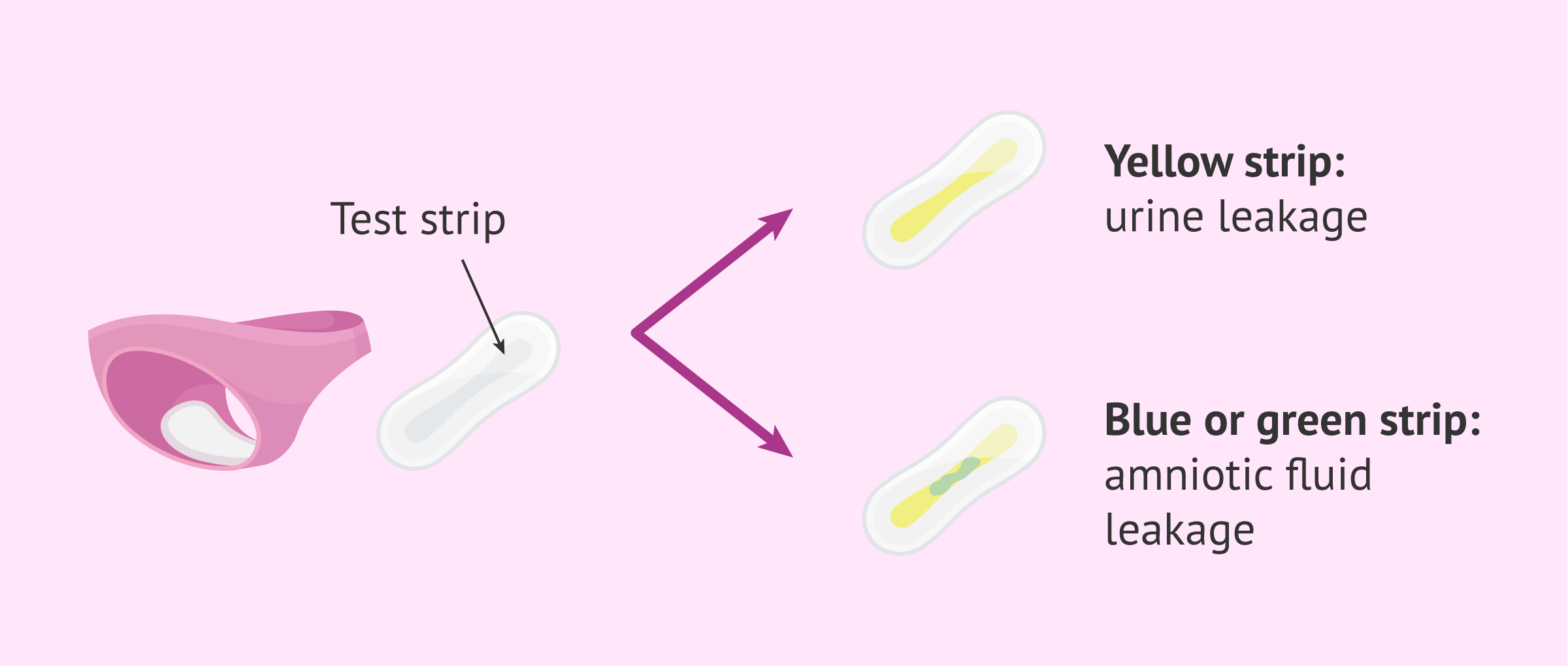 Imagen: Home test to distinguish urine from amniotic fluid