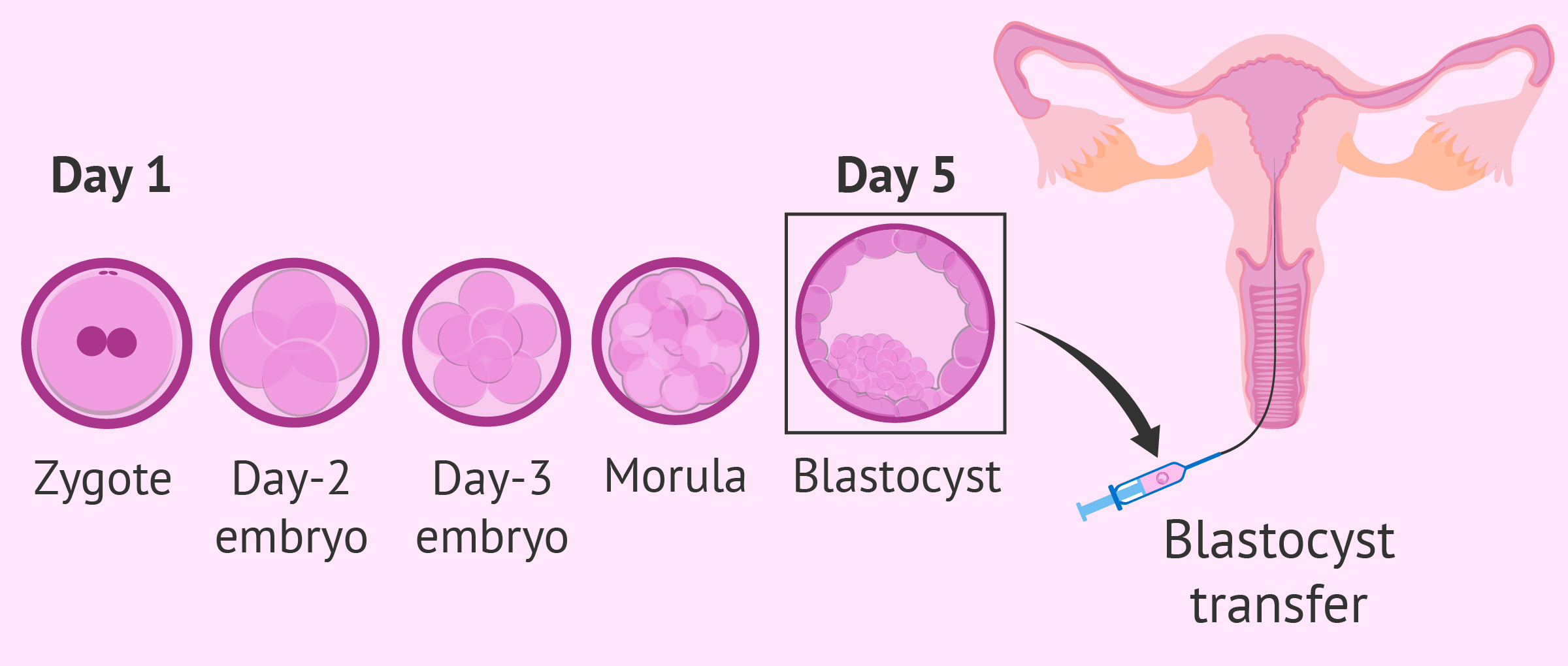 Culture to blastocyst: process day by day