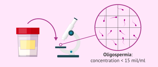 Imagen: What a result of oligozoospermia means in your semen analysis