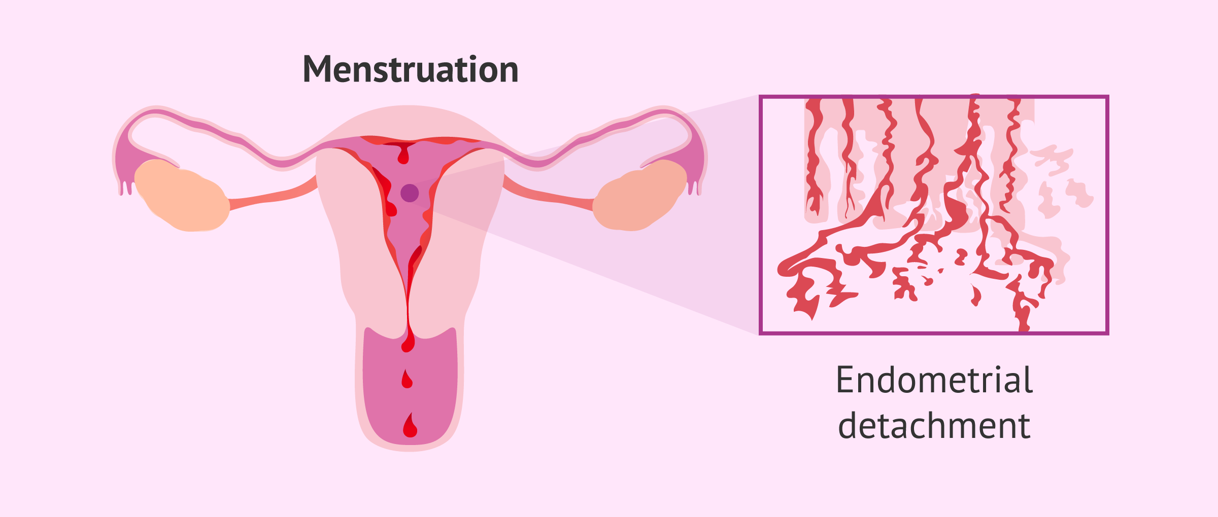 Menstruation: detachment of the endometrium