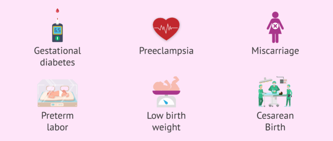 Risks of getting pregnant at 50