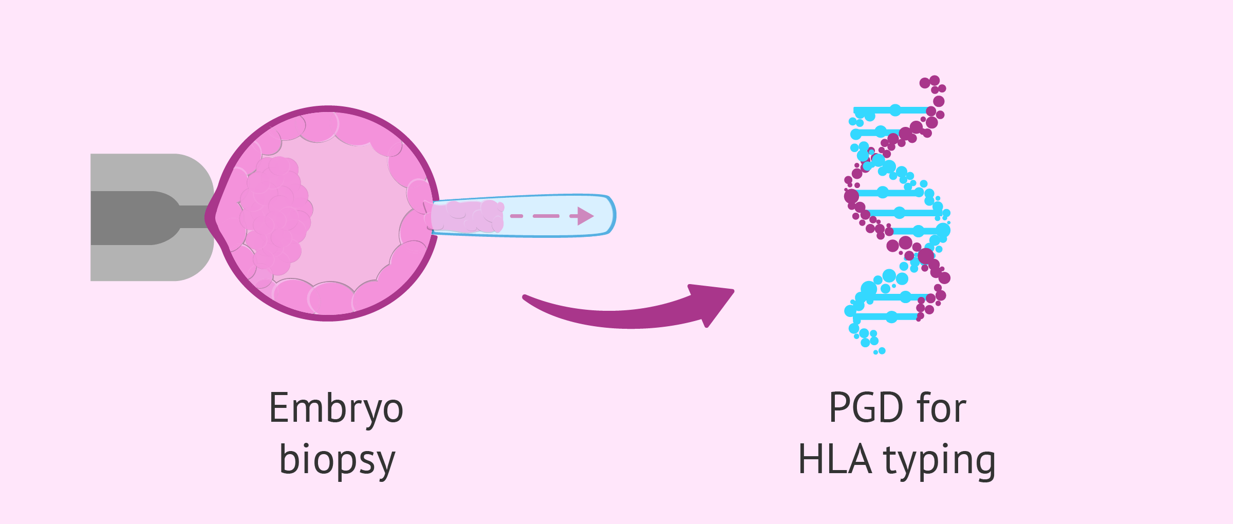 PGD for embryo selection