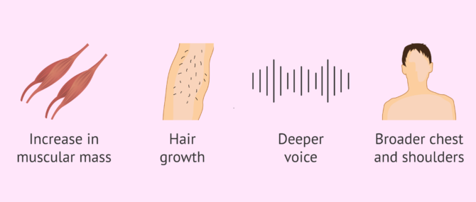 Imagen: Male sexual development