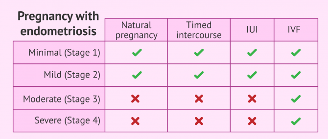 Can You Get Pregnant with Endometriosis? – Your Chances of Success