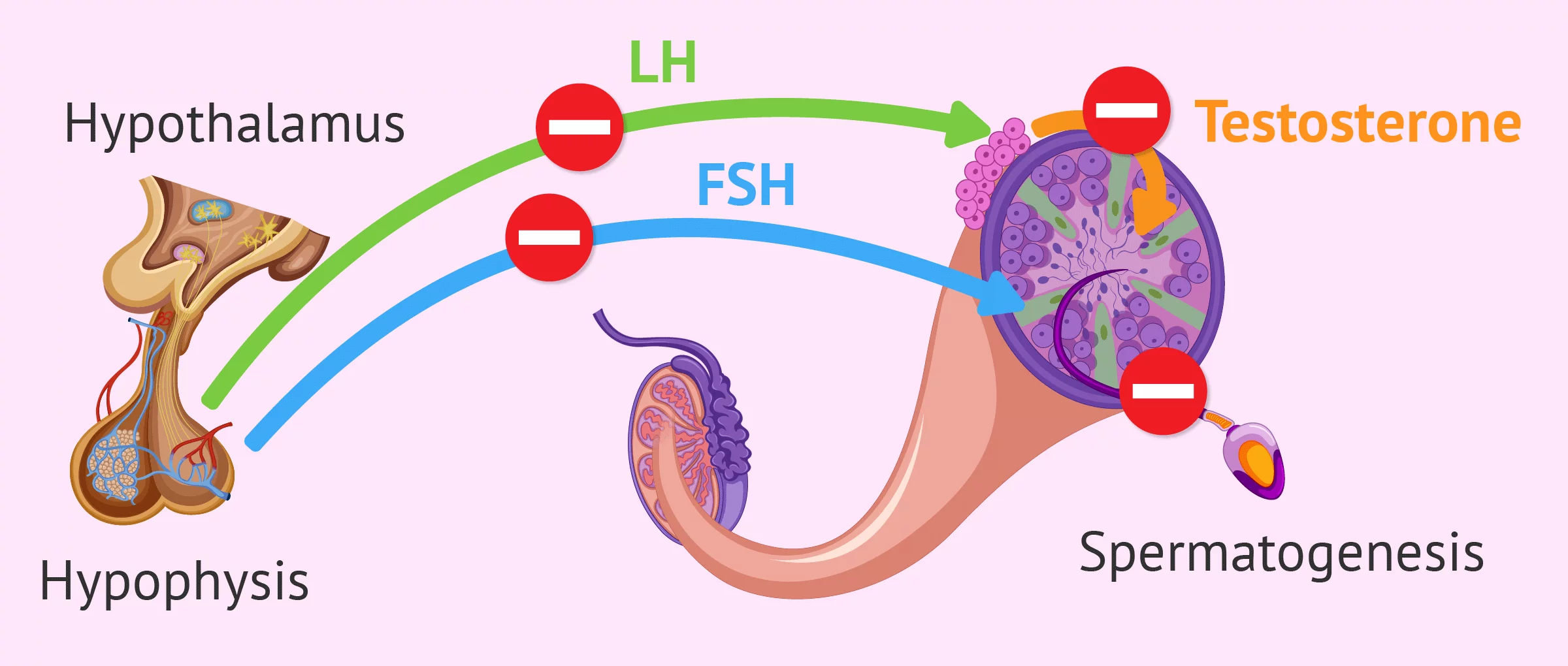 Endocrine cause in male sterility