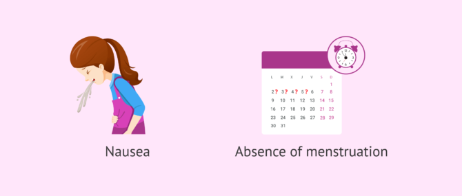 Imagen: Common symptoms in the second month of pregnancy