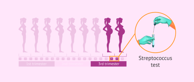 Imagen: Strep test in the ninth month of pregnancy