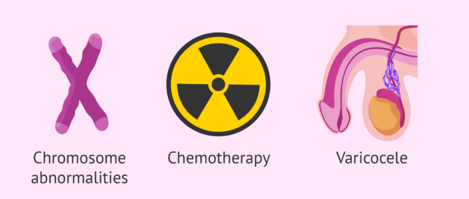 Imagen: Testicular causes of male sterility