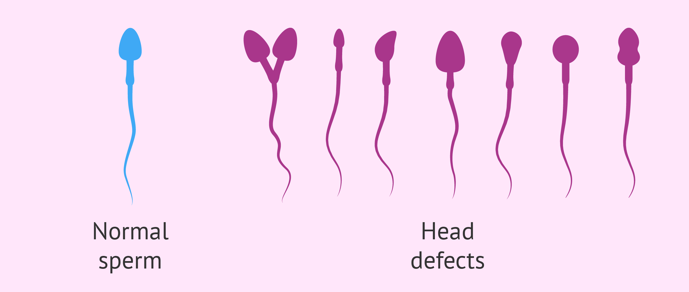 Head Defects In Sperm 