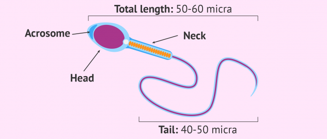 Types sperm defects