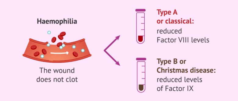 Hemo Types Two types of hemophilia